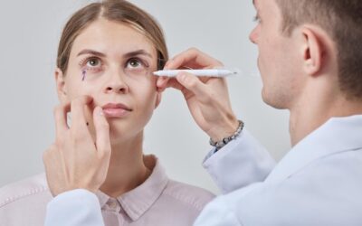 Jaki zabieg na sińce pod oczami warto rozważyć?