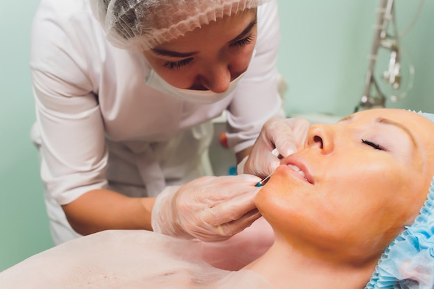 Jak dbać o usta po zabiegu kwasem, by cieszyć się efektem?