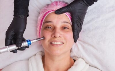 Mezoterapia bezigłowa jak często powtarzać żeby osiągnąć najlepsze efekty?
